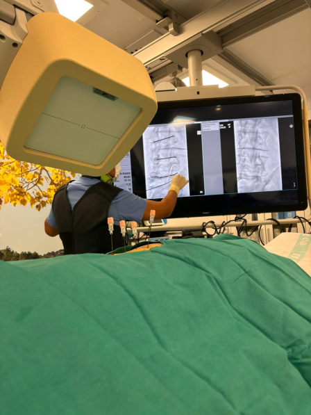 fluoroscopia_casos_reales_1