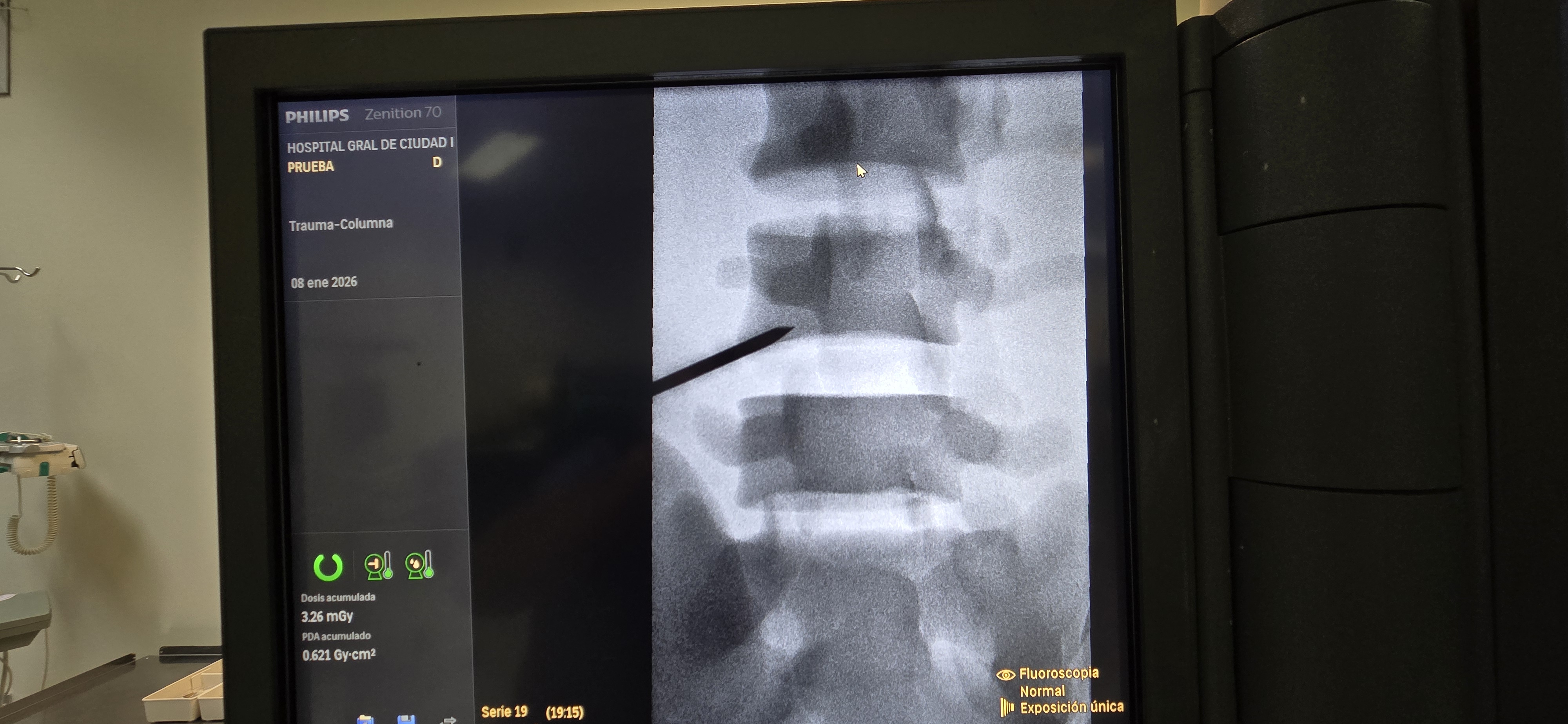 fantomas de fluoroscopia_5