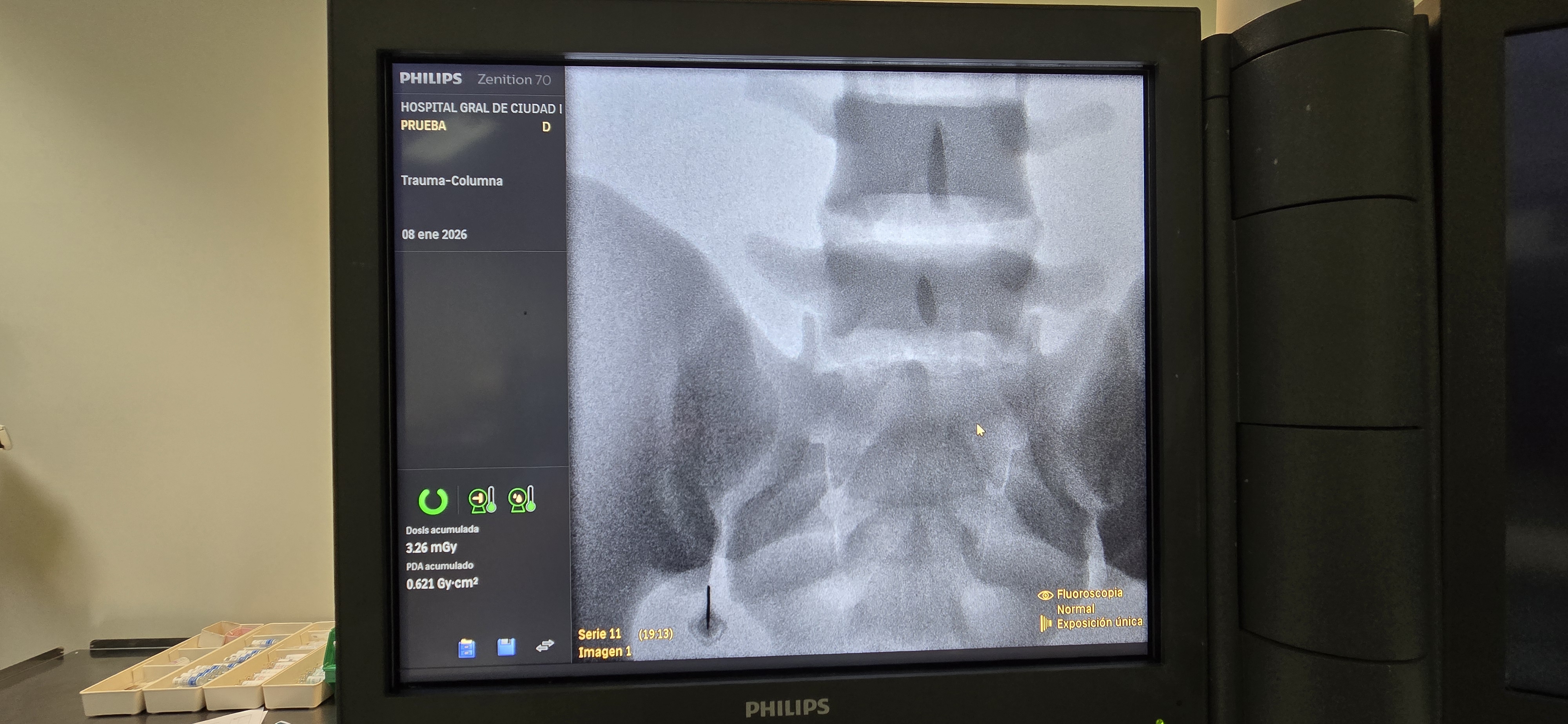 fantomas de fluoroscopia_6